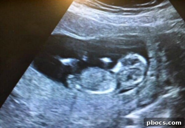 Finding Our Dream Car + A Sweet Surprise